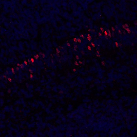 In red a developmentally regulated transcription factor in the CA1 and in blue DAPI